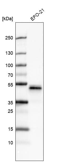 Analysis in human cell line EFO-21.