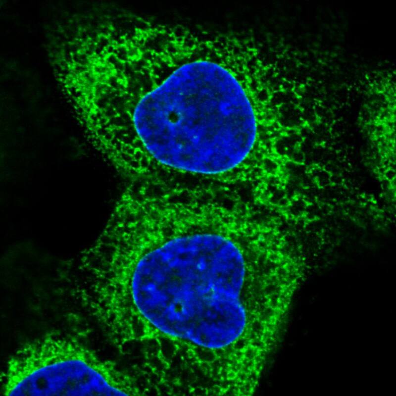 Staining in A431 cell line  showing specific staining of endoplasmic reticulum in green. Microtubule- and nuclear probes are visualized in red and blue respectively (where available).