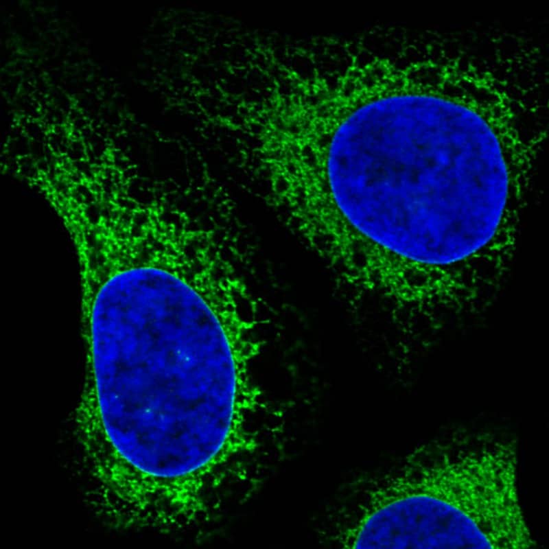 Staining in U2OS cell line  showing specific staining of endoplasmic reticulum in green. Microtubule- and nuclear probes are visualized in red and blue respectively (where available).