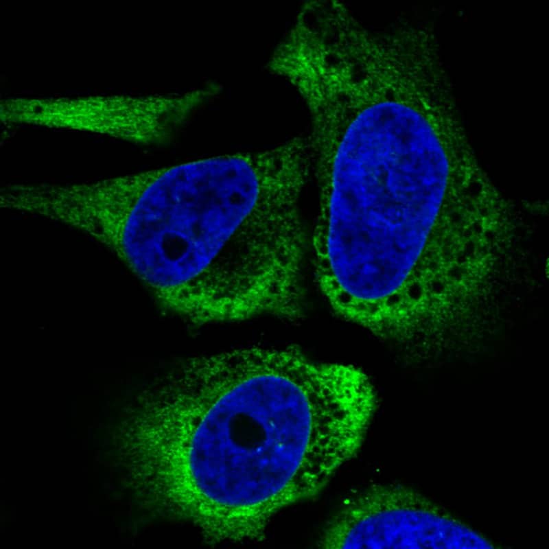 Staining in U251 cell line  showing specific staining of endoplasmic reticulum in green. Microtubule- and nuclear probes are visualized in red and blue respectively (where available).