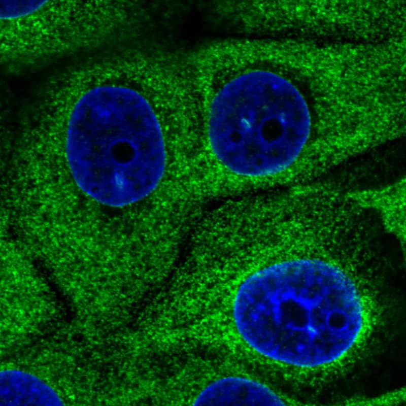 Staining in MCF7 cell line  showing specific staining of endoplasmic reticulum in green. Microtubule- and nuclear probes are visualized in red and blue respectively (where available).