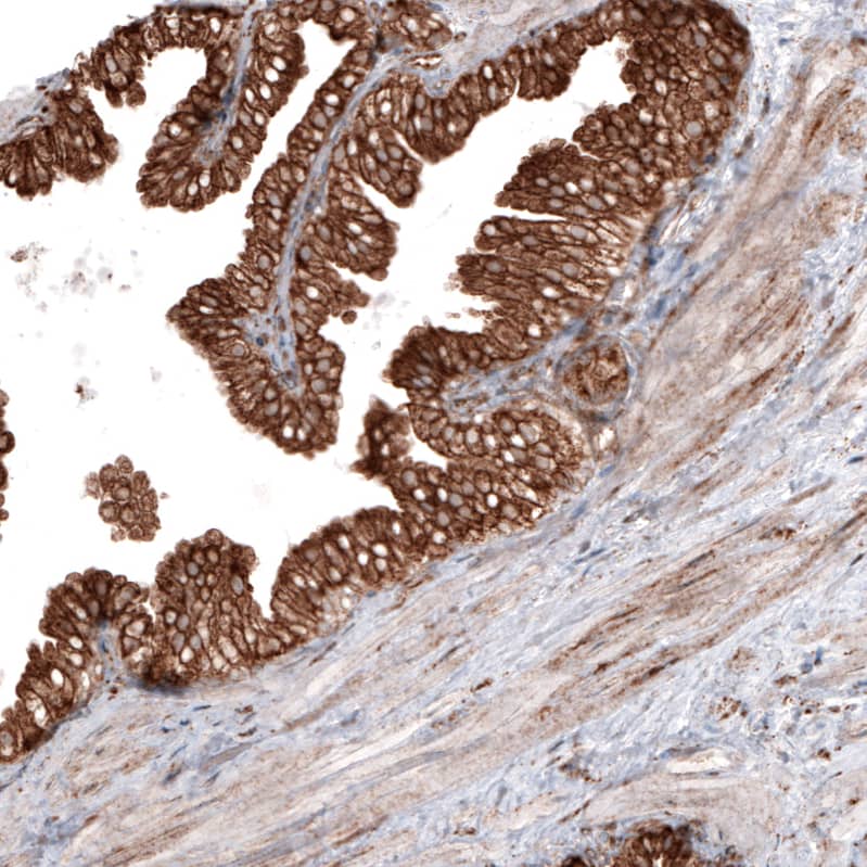 Staining of human prostate shows strong cytoplasmic positivity in glandular cells.