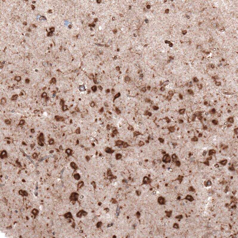 Staining of human cerebral cortex shows strong cytoplasmic positivity in neurons.