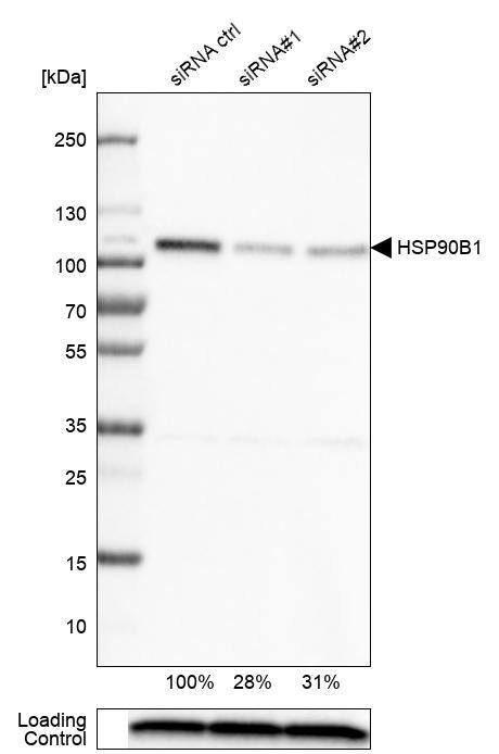 Analysis in U-251MG cells transfected with control siRNA, target specific siRNA probe #1 and #2,. Remaining relative intensity is presented. Loading control: Anti-PPIB.