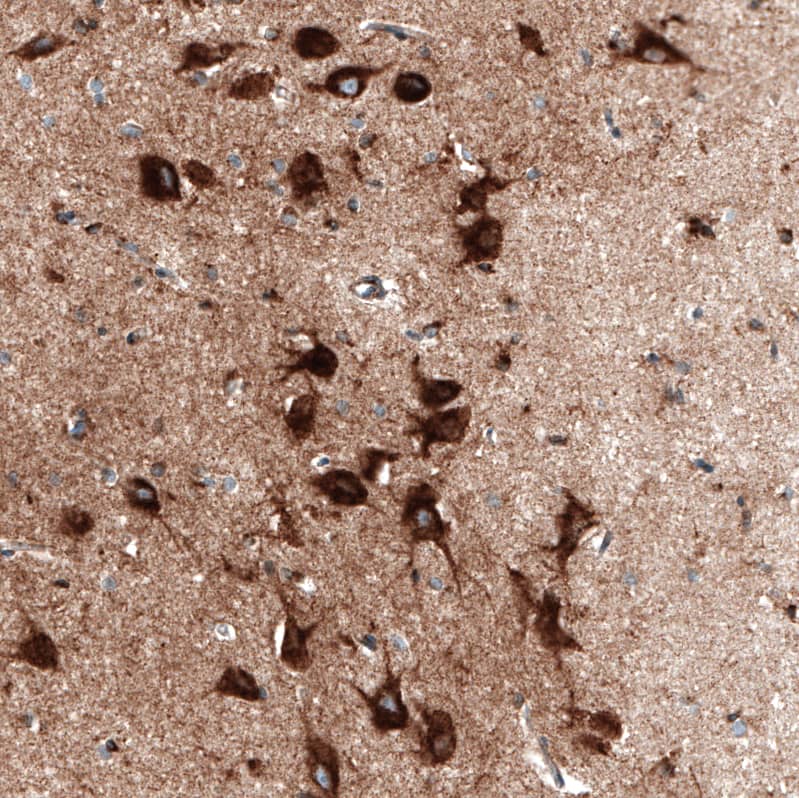 Staining of human cerebral cortex shows strong cytoplasmic positivity in neurons.
