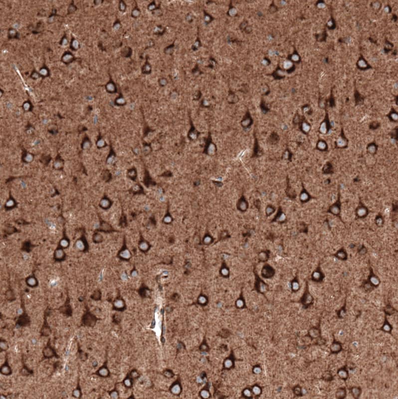 Staining of mouse cerebral cortex shows strong cytoplasmic positivity in neurons.