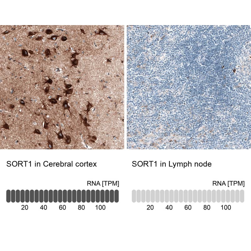 Analysis in human cerebral cortex and lymph node tissues. Corresponding Sortilin RNA-seq data are presented for the same tissues.