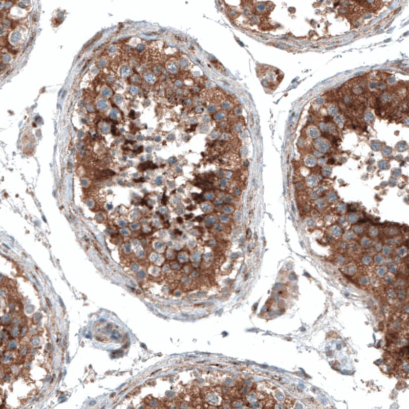 Staining of human testis shows strong cytoplasmic positivity in cells in seminiferous ducts.