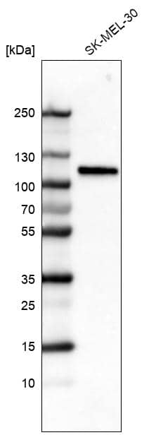 Analysis in human cell line SK-MEL-30.