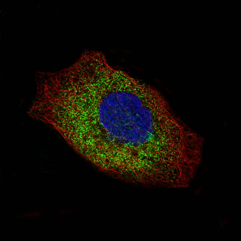 Staining of A-431 cells showing specific staining in the cytosol in green. Microtubule- and nuclear probes are visualized in red and blue, respectively (where available).