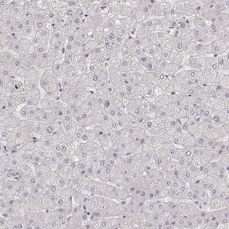Staining of human liver shows no positivity in hepatocytes as expected.