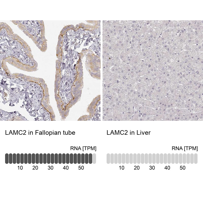 Analysis in human fallopian tube and liver tissues. Corresponding LAMC2 RNA-seq data are presented for the same tissues.