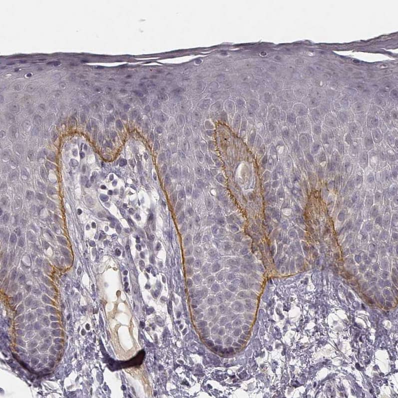 Staining of human skin shows moderate positivity in basement membrane of epidermis.