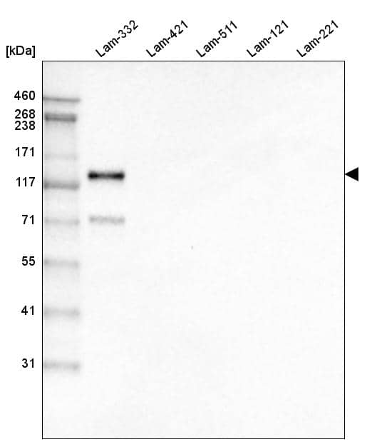Analysis of purified human recombinant Laminin-332, Laminin-421, Laminin-511, Laminin-121 and Laminin-221.