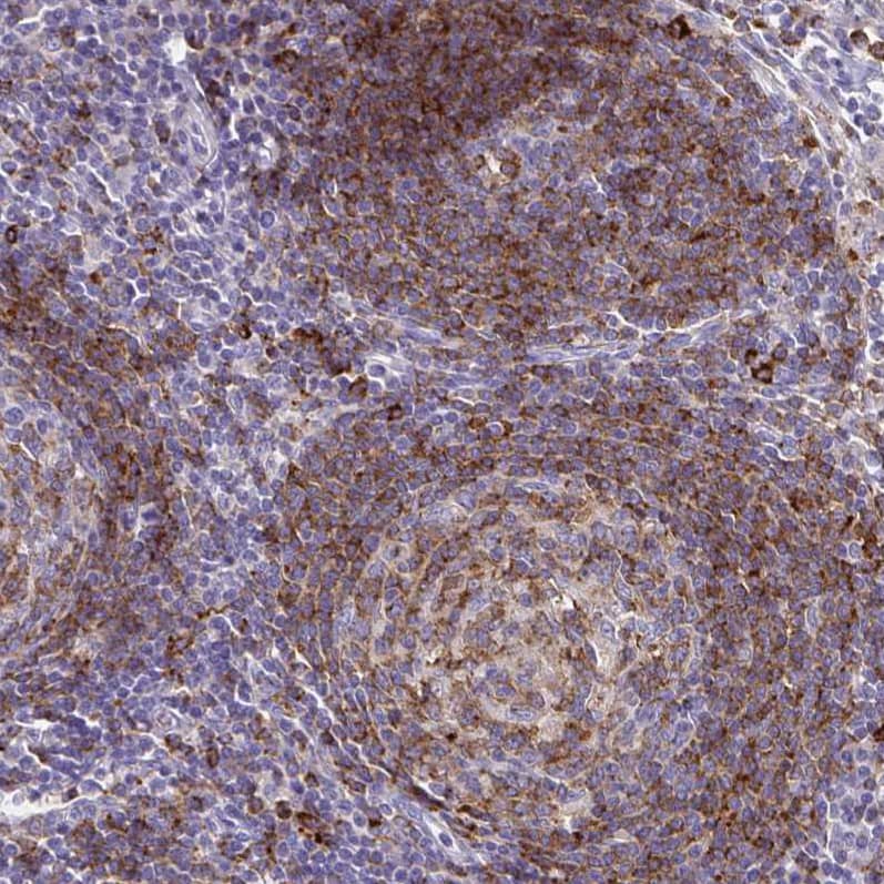Staining of human lymph node shows moderate to strong cytoplasmic positivity in lymphoid cells.