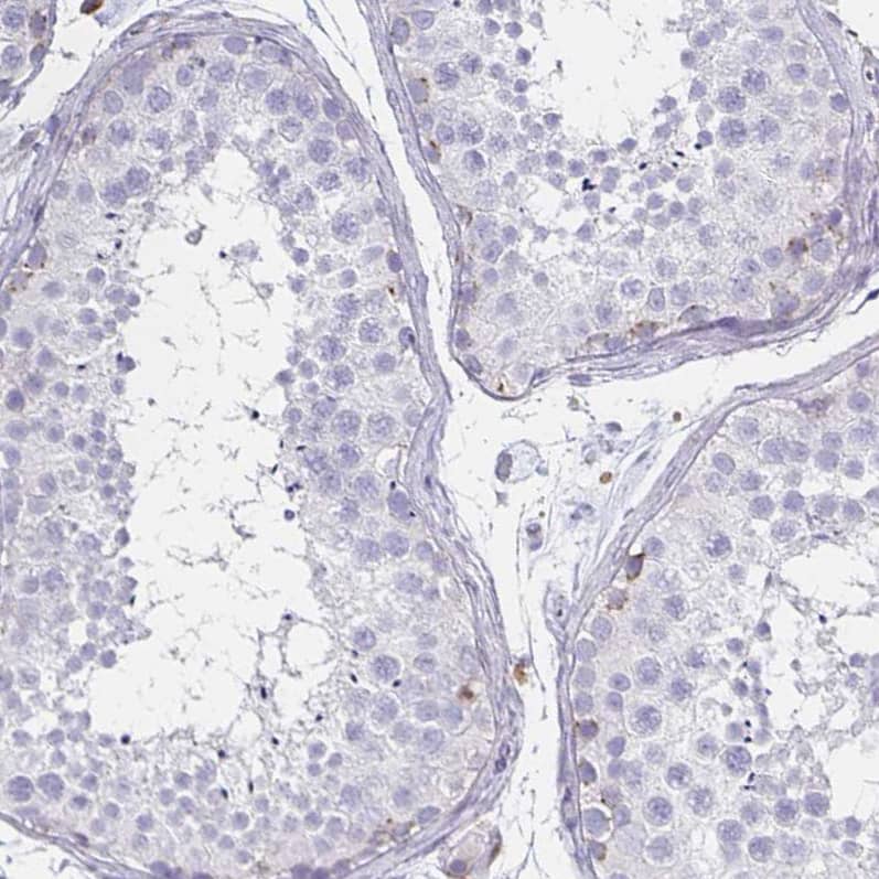 Staining of human testis shows no positivity in cells in seminiferous ducts as expected.