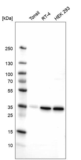 Analysis in human tonsil tissue, human cell line RT-4 and human cell line HEK 293.