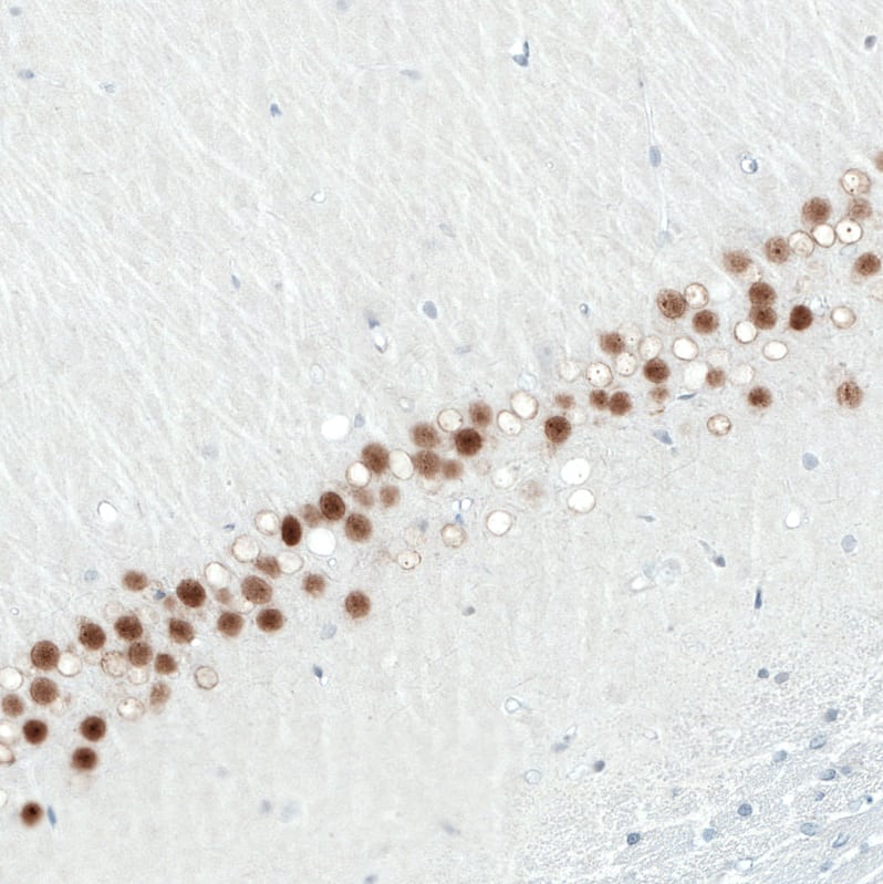Staining of rat hippocampus shows moderate to strong nuclear positivity in CA1 layer neurons.