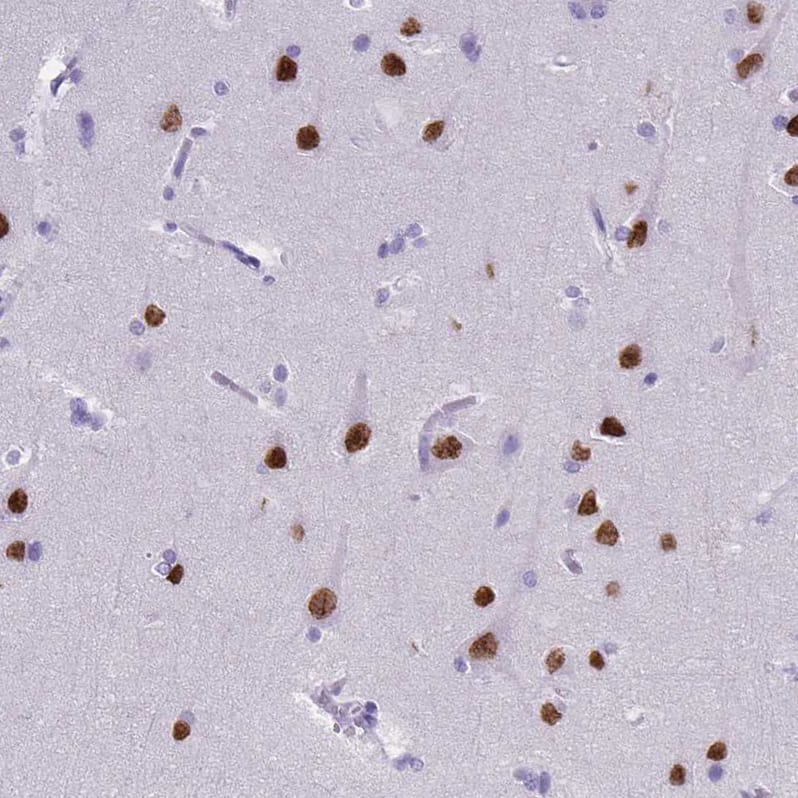 Staining of human cerebral cortex shows strong nuclear positivity in neurons.