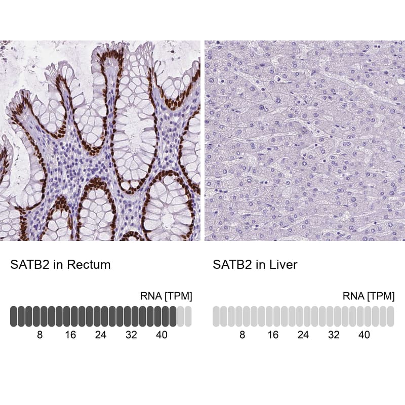 Analysis in human rectum and liver tissues. Corresponding SATB2 RNA-seq data are presented for the same tissues.