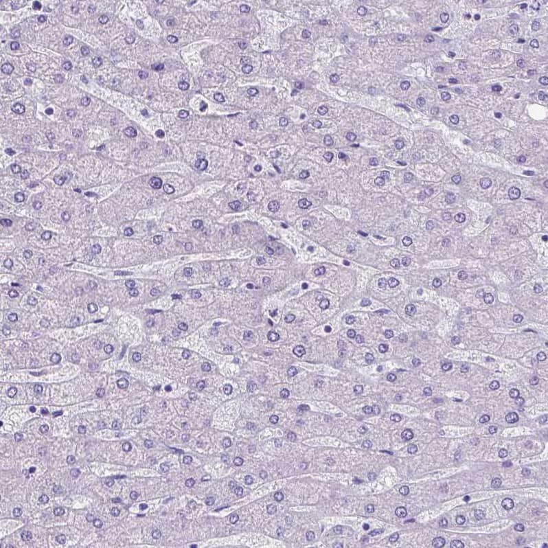 Staining of human liver shows no positivity in hepatocytes as expected.