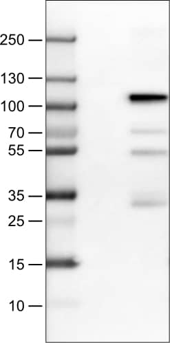 Lane 1: Marker [kDa]Lane 2: Negative control (vector only transfected HEK293T lysate)�Lane 3: SATB2 Over-expression Lysate (Co-expressed with a C-terminal myc-DDK tag (~3.1 kDa) in mammalian HEK293T cells, LY414656)