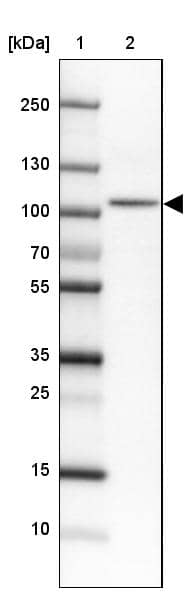 Lane 1: Marker [kDa]Lane 2: Human cell line HEL