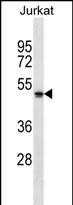 Western Blot:NBPF5 Antibody (RB31222)[NBP3-52104]- NBPF5 Antibody (C-term) western blot analysis in Jurkat cell line lysates (35ug/lane).This demonstrates the NBPF5 antibody detected the NBPF5 protein (arrow).