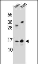 TAF11L2 Antibody (Center) western blot analysis in Hela,K562 cell line lysates (35ug/lane).This demonstrates the TAF11L2 antibody detected the TAF11L2 protein (arrow).