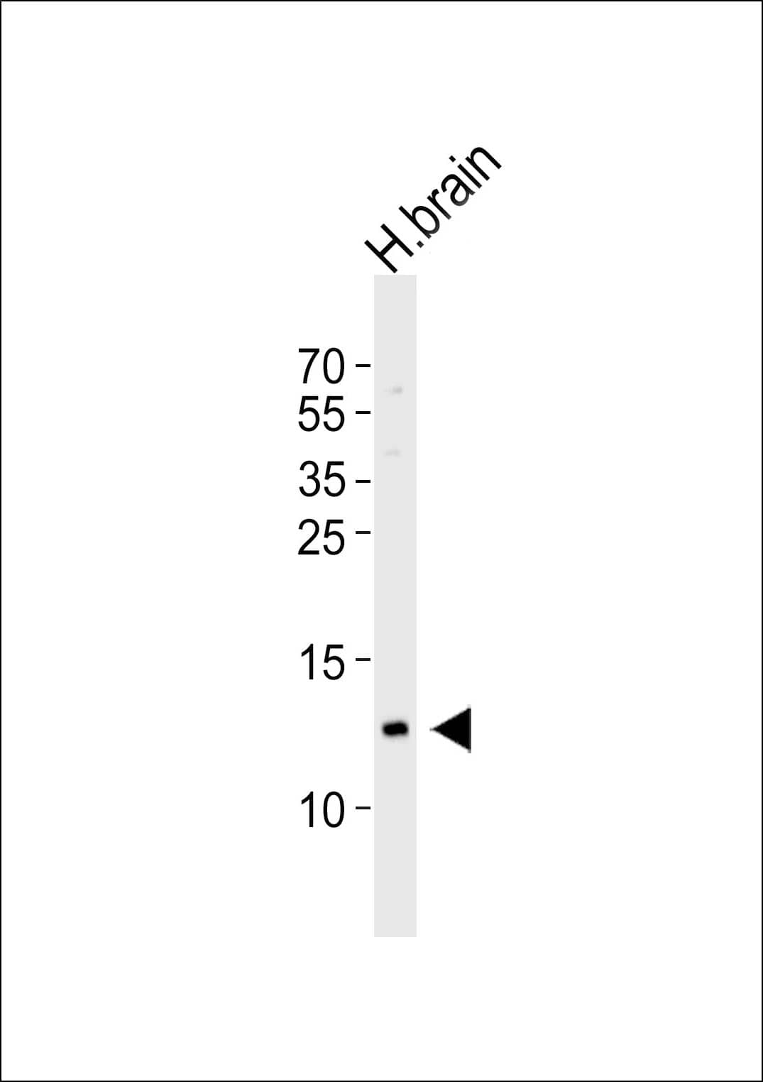 Western Blot Hemoglobin gamma 2 Antibody (RB44842)
