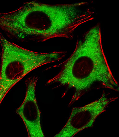 Fluorescent image of Hela cells stained with RPLP0P6 Antibody (N-term).  was diluted at 1:25 dilution. An Alexa Fluor 488-conjugated goat anti-rabbit lgG at 1:400 dilution was used as the secondary antibody (green). Cytoplasmic actin was counterstained with Alexa Fluor� 555 conjugated with Phalloidin (red).