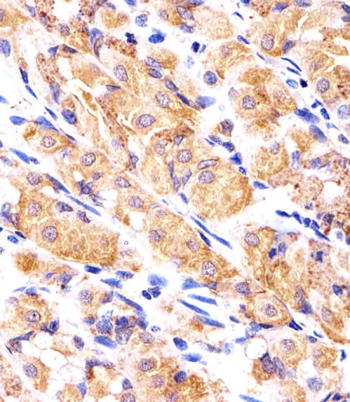 Fluorescent image of Hela cells stained with RPLP0P6 Antibody (N-term). was diluted at 1:25 dilution. An Alexa Fluor 488-conjugated goat anti-rabbit lgG at 1:400 dilution was used as the secondary antibody (green). Cytoplasmic actin was counterstained with Alexa Fluor� 555 conjugated with Phalloidin (red).