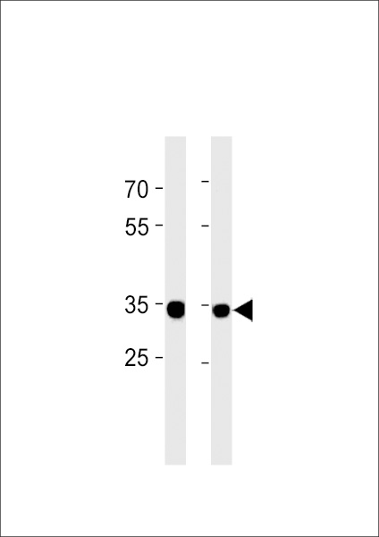 Fluorescent image of Hela cells stained with RPLP0P6 Antibody (N-term). was diluted at 1:25 dilution. An Alexa Fluor 488-conjugated goat anti-rabbit lgG at 1:400 dilution was used as the secondary antibody (green). Cytoplasmic actin was counterstained with Alexa Fluor� 555 conjugated with Phalloidin (red).
