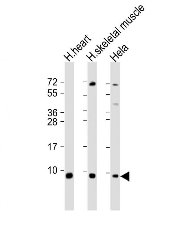 All lanes : Anti-ATP5E Antibody (C-Term) at 1:2000 dilutionLane 1: human heart lysateLane 2: human skeletal muscle lysateLane 3: Hela whole cell lysateLysates/proteins at 20 �g per lane. SecondaryGoat Anti-Rabbit IgG, (H+L), Peroxidase conjugated at 1/10000 dilution. Predicted band size : 6 kDaBlocking/Dilution buffer: 5% NFDM/TBST.