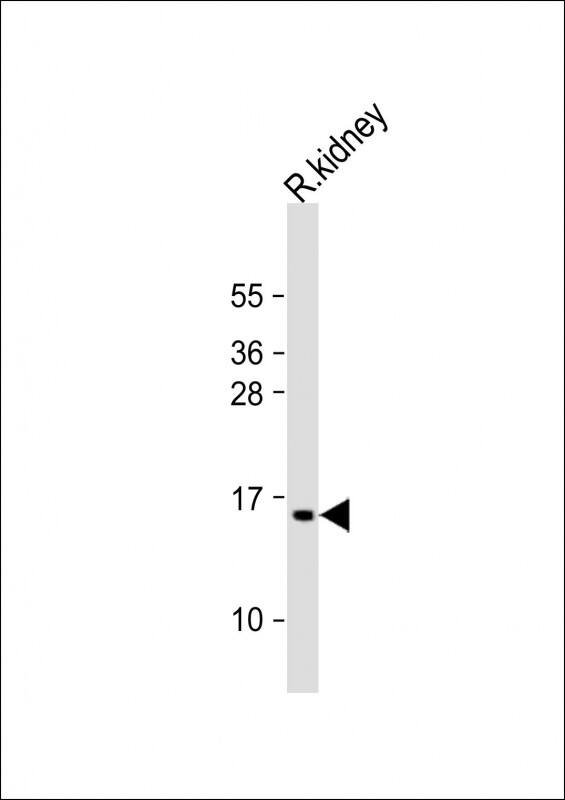 Anti-ATP5G3 Antibody (N-Term) at 1:2000 dilution + rat kidney lysateLysates/proteins at 20 �g per lane. SecondaryGoat Anti-Rabbit IgG, (H+L), Peroxidase conjugated at 1/10000 dilution. Predicted band size : 15 kDaBlocking/Dilution buffer: 5% NFDM/TBST.