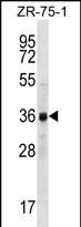 CCNYL2 Antibody (Center) western blot analysis in ZR-75-1 cell line lysates (35ug/lane).This demonstrates the CCNYL2 antibody detected the CCNYL2 protein (arrow).