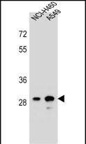 Western Blot DHRS4L1 Antibody (RB31557)