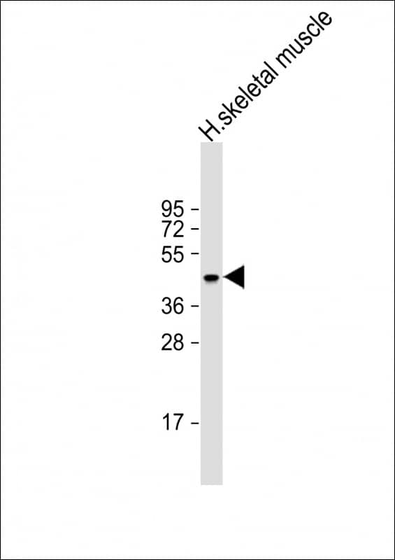 Anti-ERVK-21 Antibody (Center) at 1:2000 dilution + human skeletal muscle lysateLysates/proteins at 20 �g per lane. SecondaryGoat Anti-Rabbit IgG, (H+L), Peroxidase conjugated at 1/10000 dilution. Predicted band size : 79 kDaBlocking/Dilution buffer: 5% NFDM/TBST.