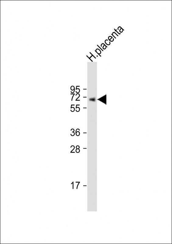 Anti-ERVK-7 Antibody (C-Term) at 1:2000 dilution + human placenta lysateLysates/proteins at 20 �g per lane. SecondaryGoat Anti-Rabbit IgG, (H+L), Peroxidase conjugated at 1/10000 dilution. Predicted band size : 67 kDaBlocking/Dilution buffer: 5% NFDM/TBST.