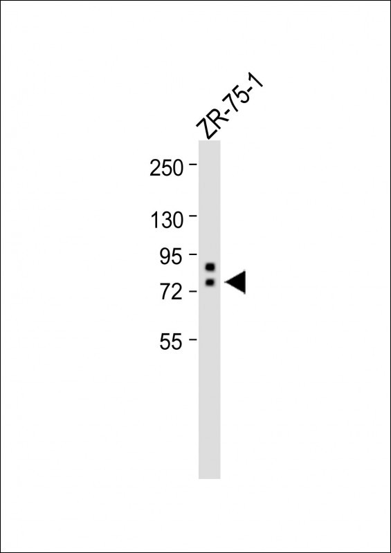 Anti-ERVK-9 Antibody (C-Term) at dilution + ZR-75-1 whole cell lysateLysates/proteins at 20 �g per lane. SecondaryGoat Anti-Rabbit IgG, (H+L), Peroxidase conjugated at 1/10000 dilution. Predicted band size : 79kDaBlocking/Dilution buffer: 5% NFDM/TBST.
