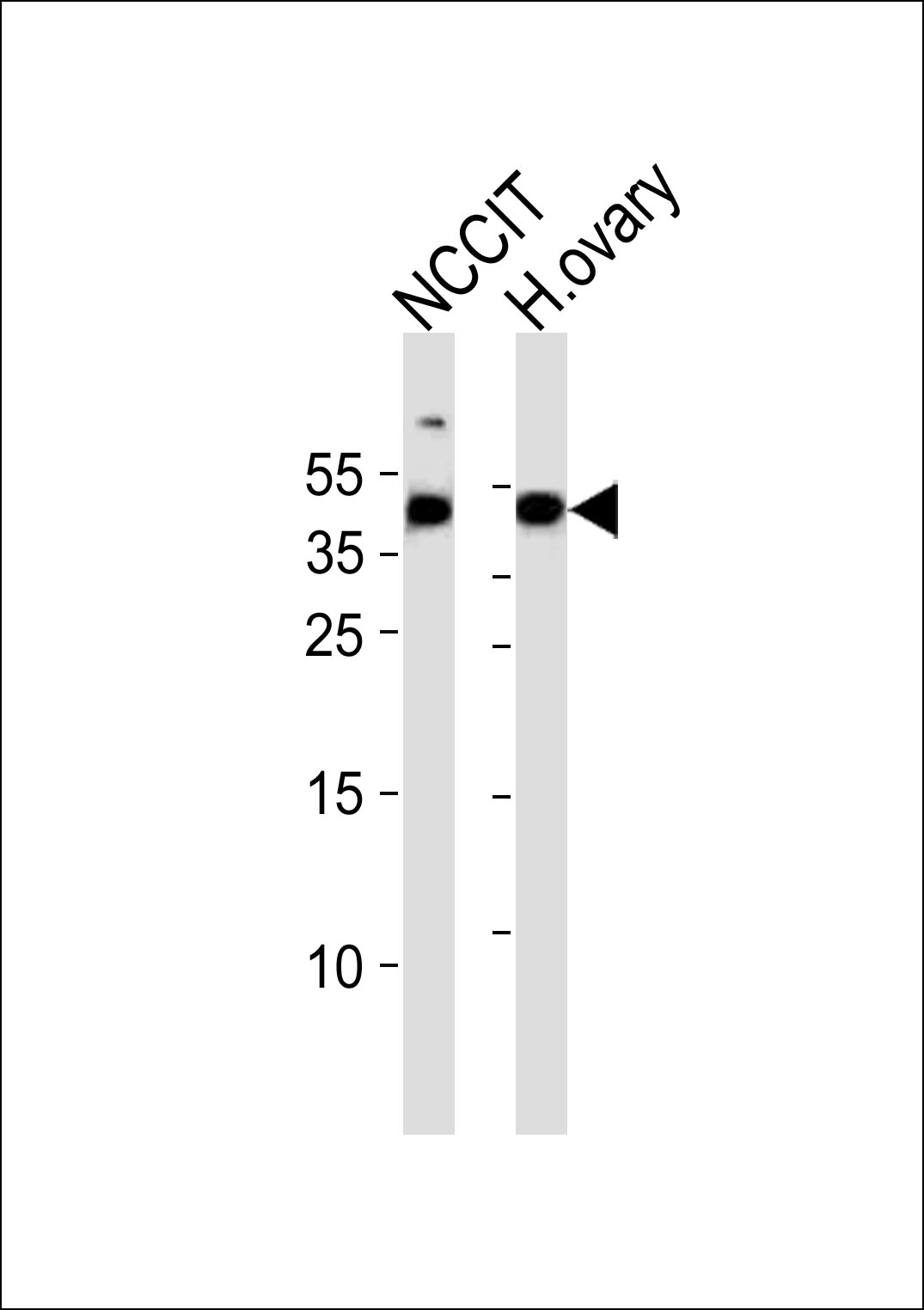 Western blot analysis of lysates from NCCIT cell line and human ovary tissue lysate (from left to right), using HESRG Antibody (Center). was diluted at 1:1000 at each lane. A goat anti-rabbit IgG H&L(HRP) at 1:5000 dilution was used as the secondary antibody. Lysates at 35ug per lane.