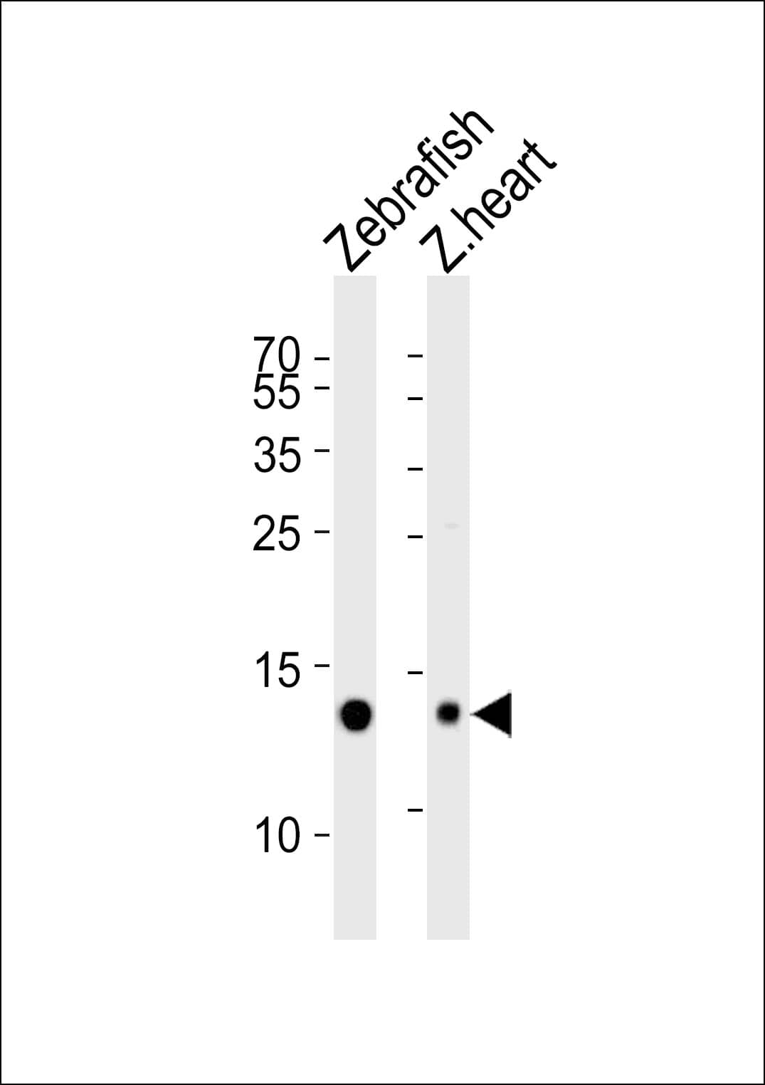 Western blot analysis of lysates from Zebrafish and zebra fish heart tissue lysate (from left to right), using (DANRE) fabp10a Antibody (Center). was diluted at 1:1000 at each lane. A goat anti-rabbit IgG H&L(HRP) at 1:5000 dilution was used as the secondary antibody. Lysates at 35ug per lane.