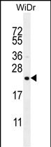 FAM237A Antibody (Center) western blot analysis in WiDr cell line lysates (35ug/lane).This demonstrates the FAM237A antibody detected the FAM237A protein (arrow).