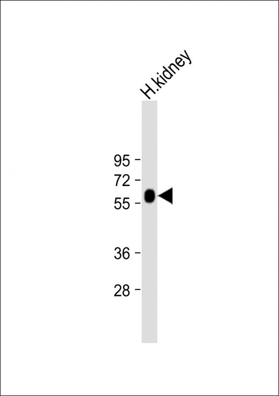 Anti-GGT3P Antibody (Center) at 1:2000 dilution + Human kidney lysateLysates/proteins at 20 �g per lane. SecondaryGoat Anti-Rabbit IgG, (H+L), Peroxidase conjugated at 1/10000 dilution. Predicted band size : 62 kDaBlocking/Dilution buffer: 5% NFDM/TBST.
