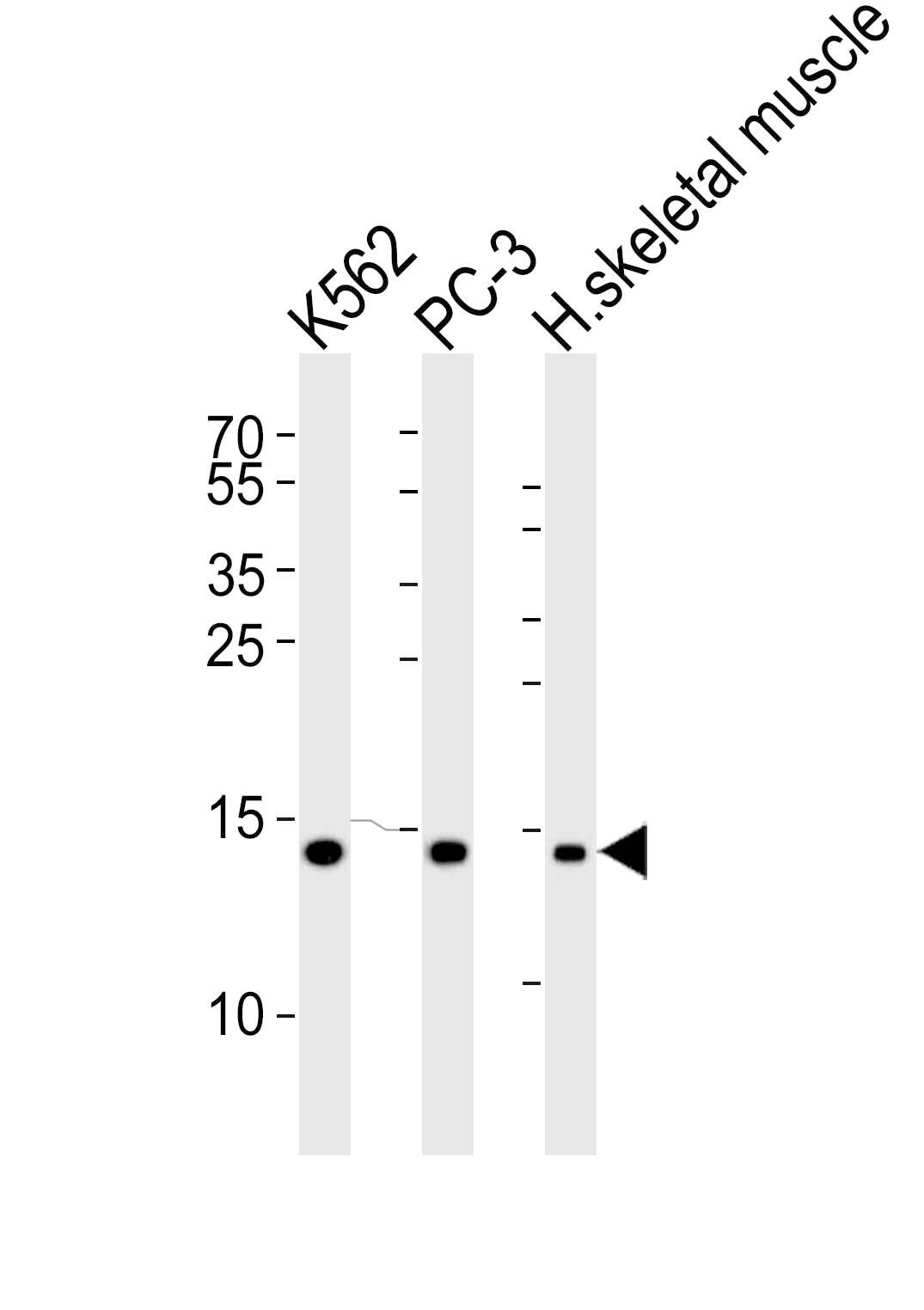 Western Blot HIST1H2BM Antibody (RB49960)