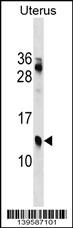 KLKP1 Antibody (N-term) western blot analysis in Uterus tissue lysates (35ug/lane).This demonstrates the KLKP1 antibody detected the KLKP1 protein (arrow).