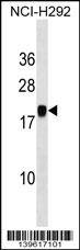 PGSF1 Antibody (Center) western blot analysis in NCI-H292 cell line lysates (35ug/lane).This demonstrates the PGSF1 antibody detected the PGSF1 protein (arrow).