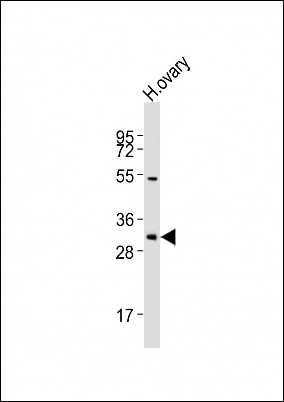 Anti-NBPF12 Antibody (Center)at 1:2000 dilution + human ovary lysatesLysates/proteins at 20 �g per lane. SecondaryGoat Anti-Rabbit IgG, (H+L), Peroxidase conjugated at 1/10000 dilutionPredicted band size : 31 kDaBlocking/Dilution buffer: 5% NFDM/TBST.