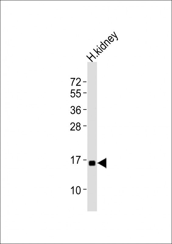 Anti-NFE4 Antibody (C-term)at 1:2000 dilution + human kidney lysatesLysates/proteins at 20 �g per lane. SecondaryGoat Anti-Rabbit IgG, (H+L), Peroxidase conjugated at 1/10000 dilutionPredicted band size : 19 kDaBlocking/Dilution buffer: 5% NFDM/TBST.