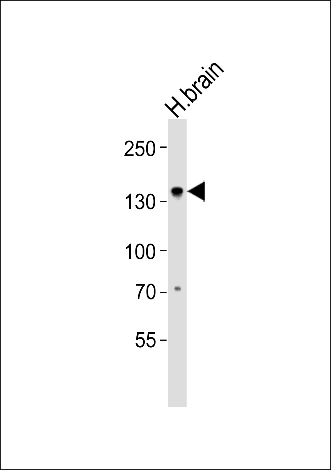 Western blot analysis of lysate from human brain tissue lysate, using OVOS1 Antibody (Center). was diluted at 1:1000. A goat anti-rabbit IgG H&L(HRP) at 1:5000 dilution was used as the secondary antibody. Lysate at 35ug.